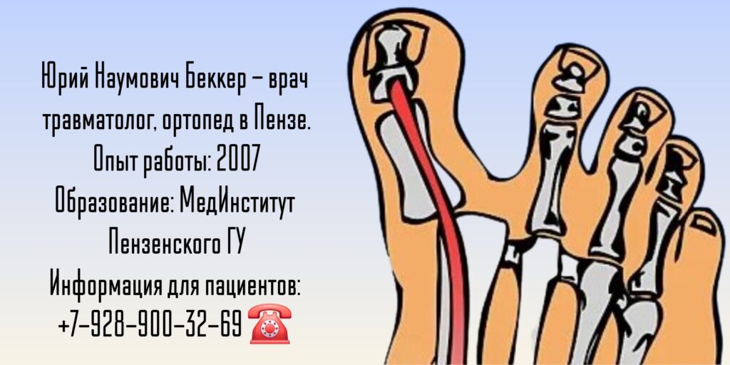 Беккер Юрий Наумович - травматолог в Пензе