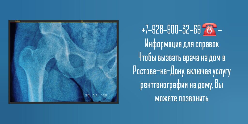 Вызов на дом врача Ростов - Рентген на дому