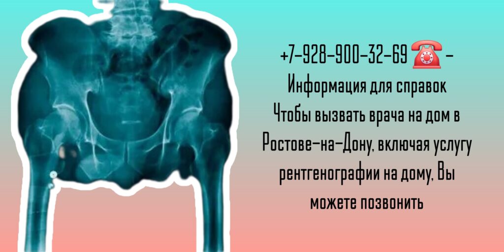 Вызов на дом врача Ростов - Рентген на дому