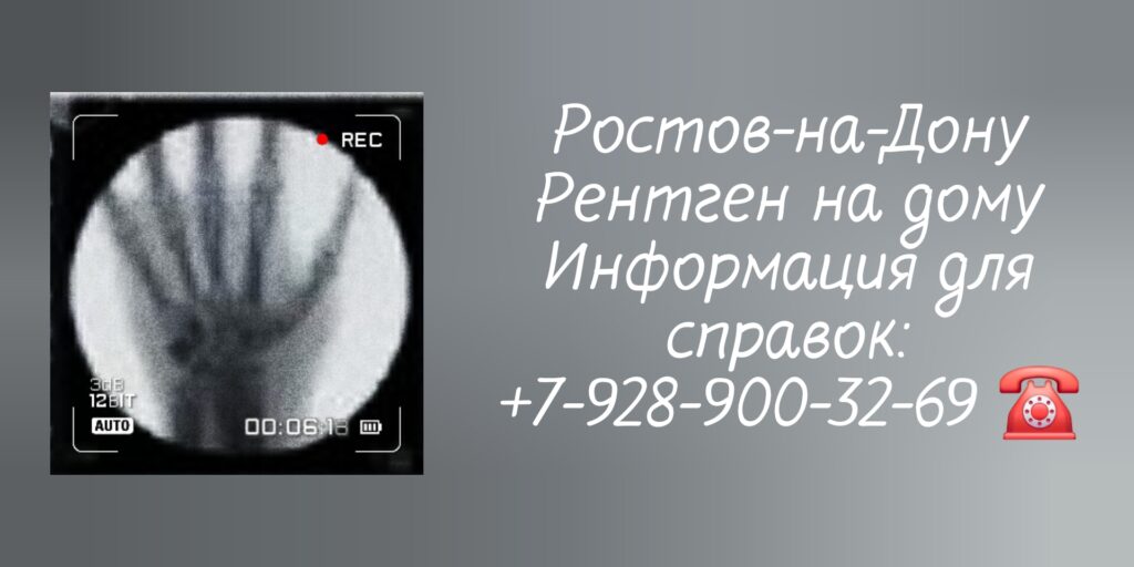 Диагностика на дому - рентген Ростов-на-Дону