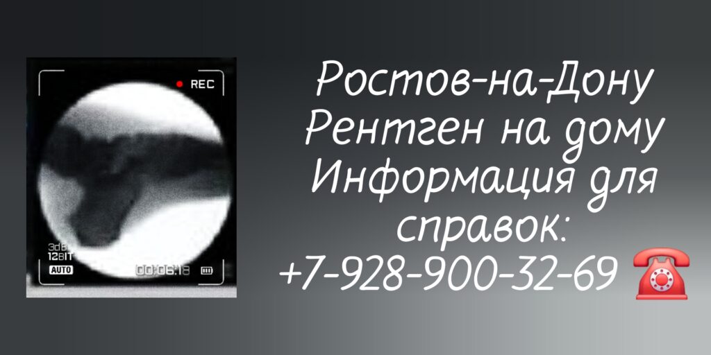 Диагностика на дому - рентген Ростов-на-Дону