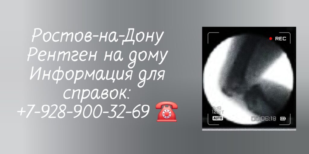 Диагностика на дому - рентген Ростов-на-Дону