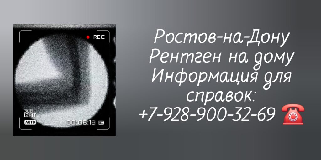 Диагностика на дому - рентген Ростов-на-Дону