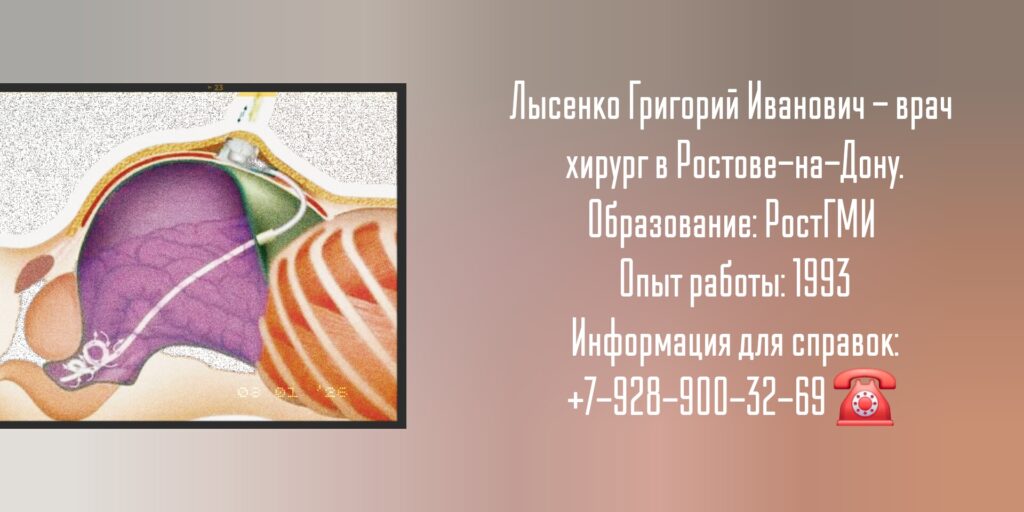 Лысенко Григорий Иванович - хирург Ростов