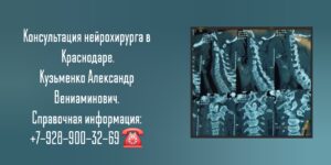 Врач нейрохирург Краснодар - Кузьменко Александр Вениаминович 