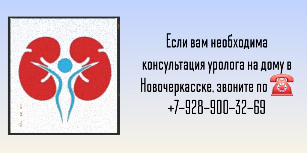 Выезд уролога на дом Новочеркасск
