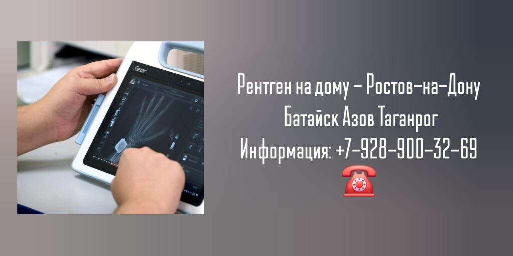 Врачи Ростова на дом - рентген на дому