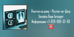 Врачи Ростова на дом - рентген на дому
