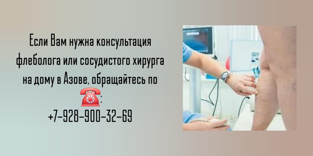 Вызов флеболога на дом Азов