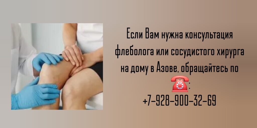 Вызов флеболога на дом Азов