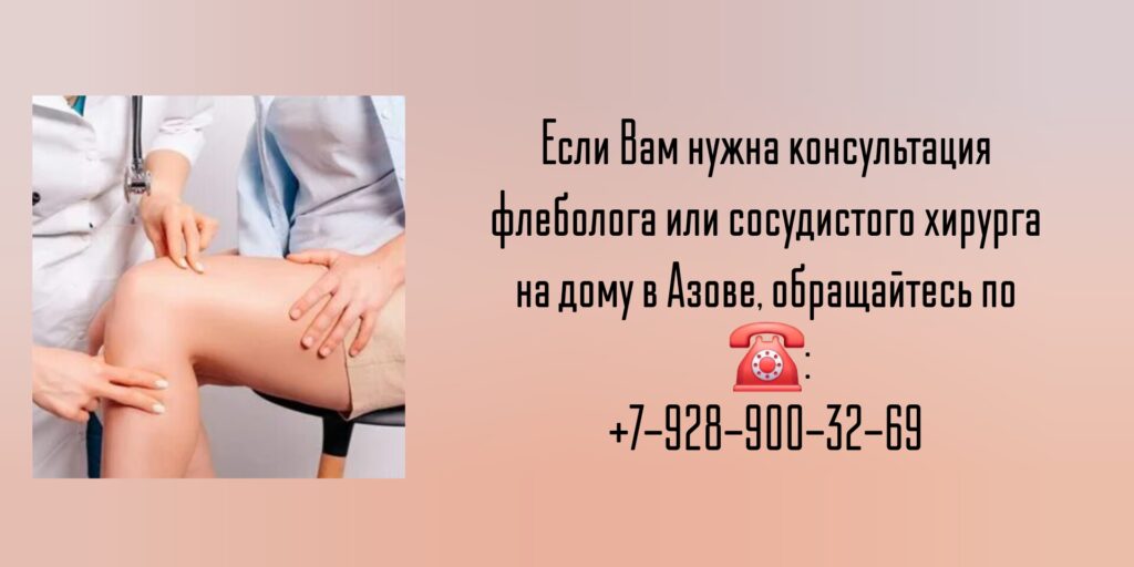 Вызов флеболога на дом Азов
