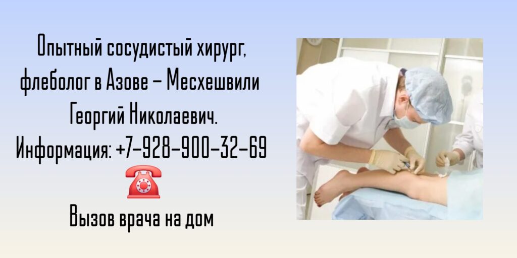 Консультация сосудистого хирурга в Азове - Месхешвили Георгий Николаевич