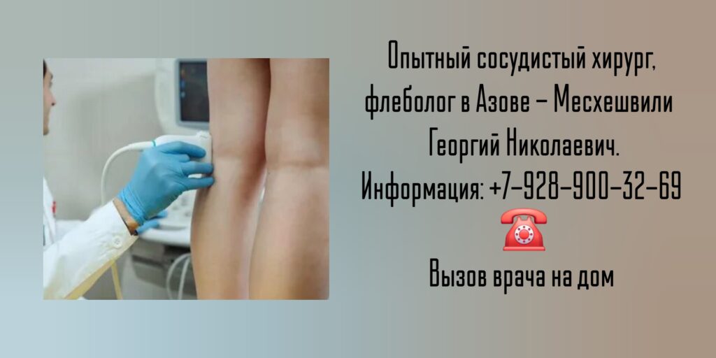 Консультация сосудистого хирурга в Азове - Месхешвили Георгий Николаевич