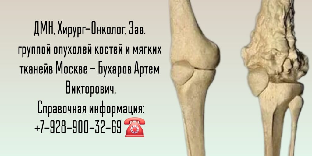 Бухаров Артем Викторович - онколог Москва