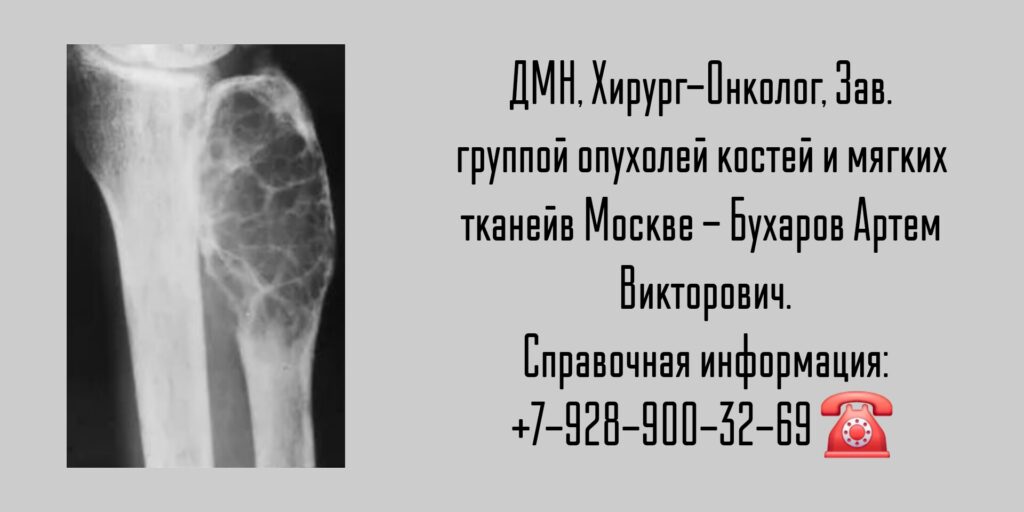 Бухаров Артем Викторович - онколог Москва