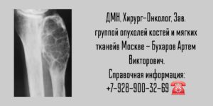 Бухаров Артем Викторович - онколог Москва