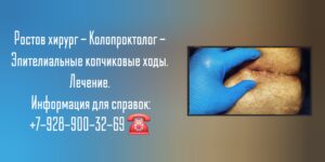 Ростов хирург - Колопроктолог - Эпителиальные копчиковые ходы 