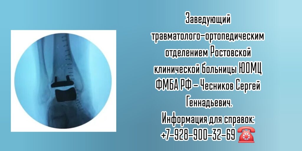Чесников Сергей Геннадьевич - операции на голеностопном суставе Ростов-на-Дону