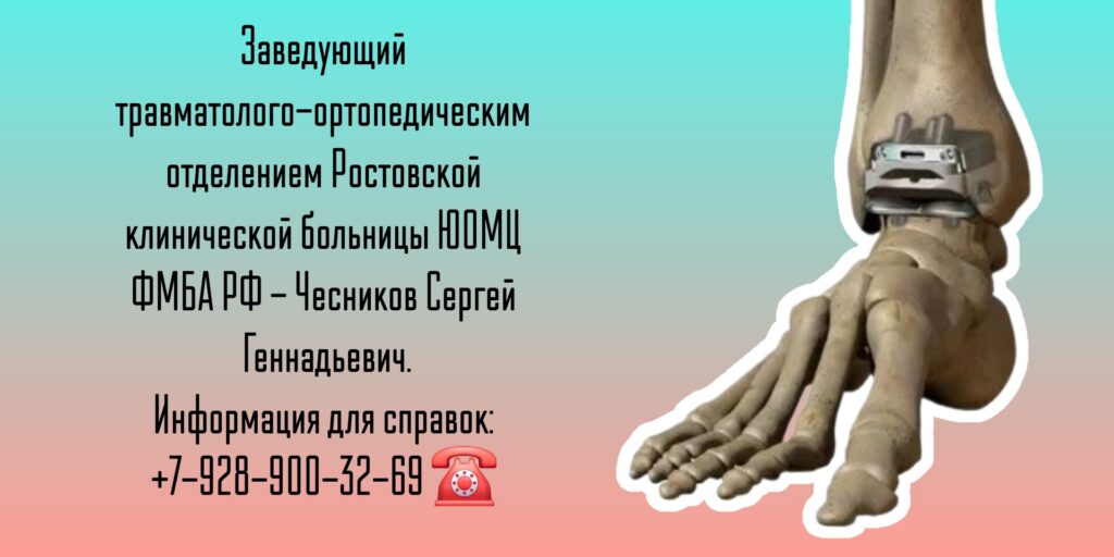 Чесников Сергей Геннадьевич - операции на голеностопном суставе Ростов-на-Дону