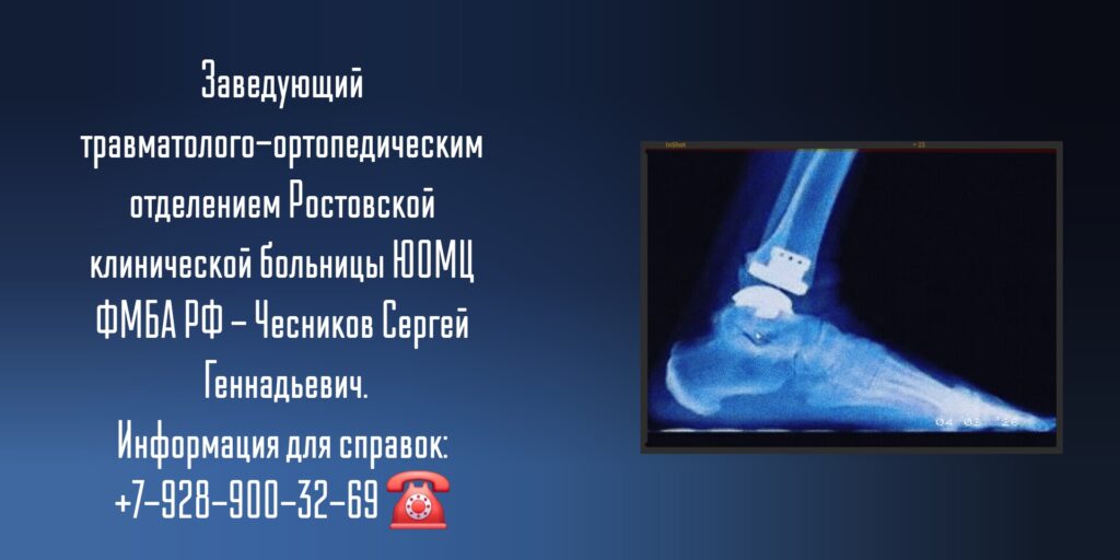 Чесников Сергей Геннадьевич - операции на голеностопном суставе Ростов-на-Дону