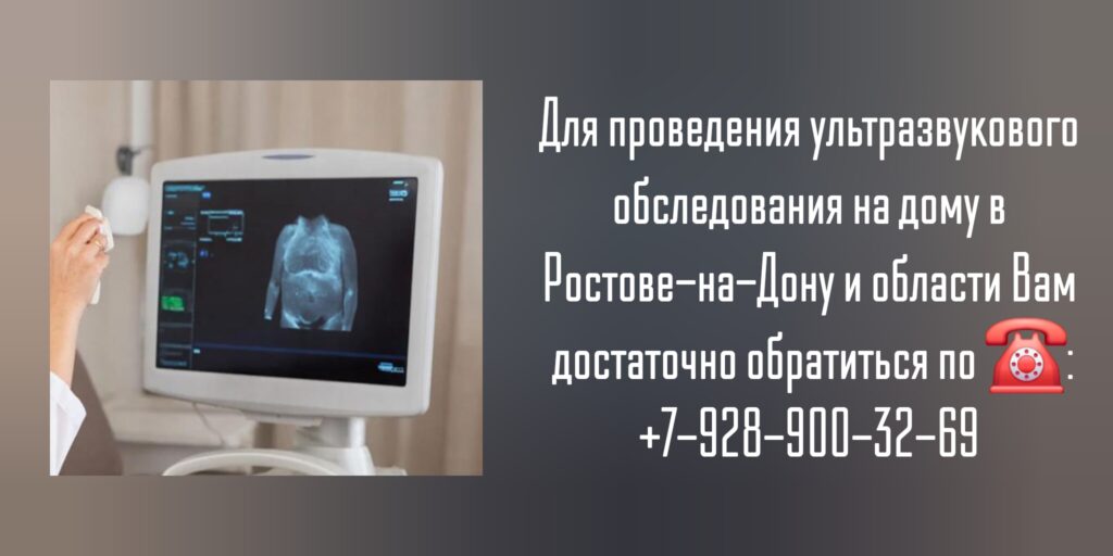Ростов сделать УЗИ на дому