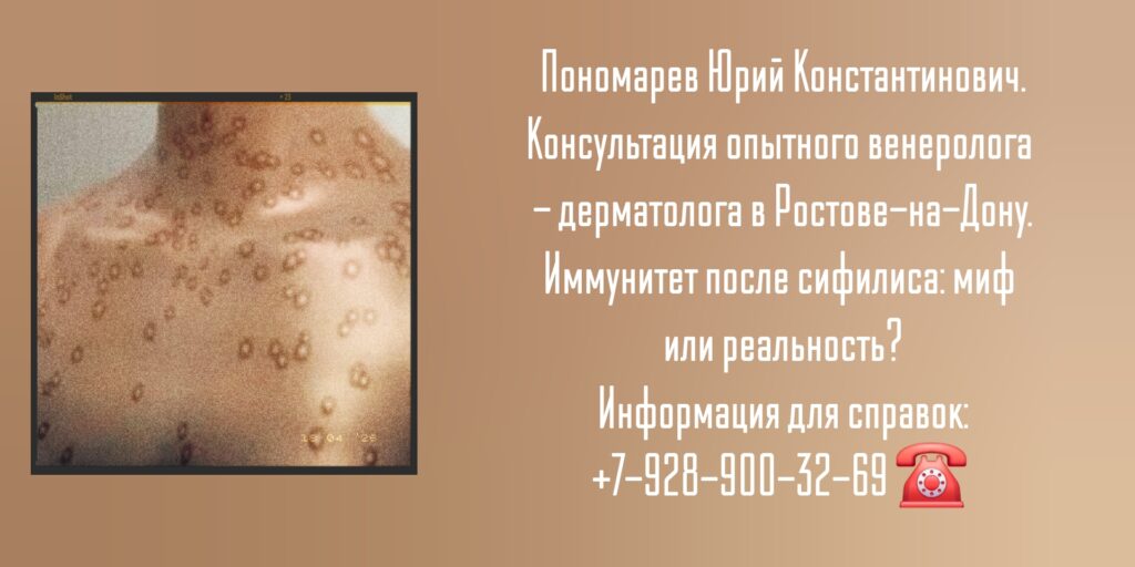 Пономарев Юрий Константинович - дерматовенеролог Ростов - Почему сифилис может вернуться?