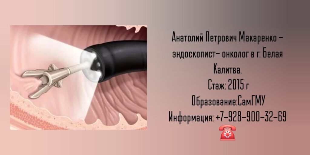 Макаренко Анатолий Петрович - онколог эндоскопист Белая Калитва