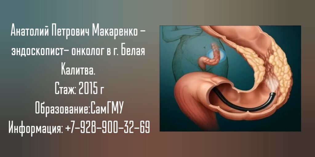 Макаренко Анатолий Петрович - онколог эндоскопист Белая Калитва
