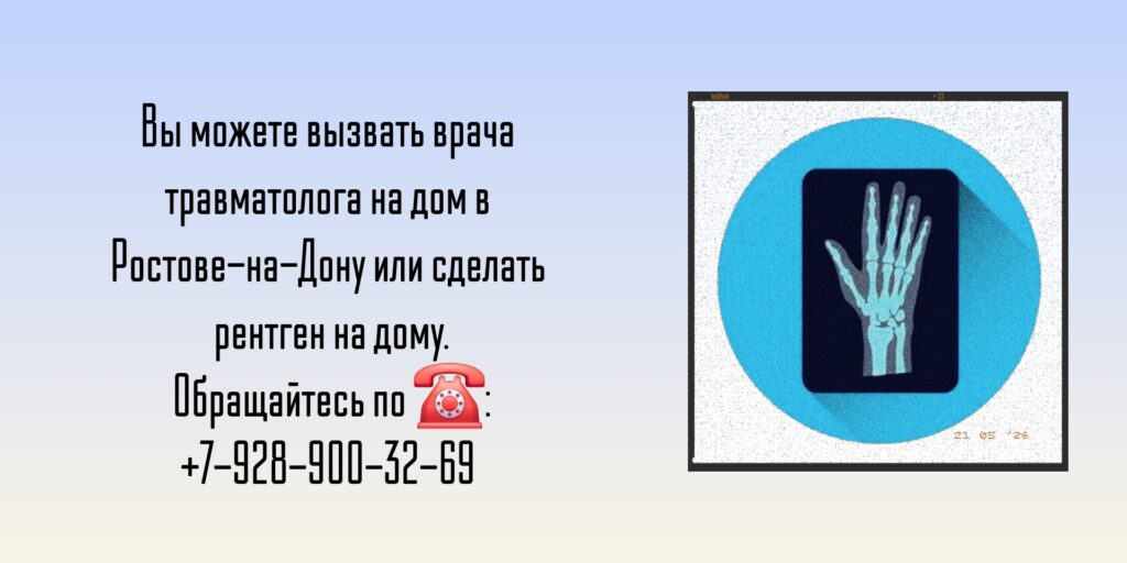 Проведение рентгена на дому в Ростове-на-Дону