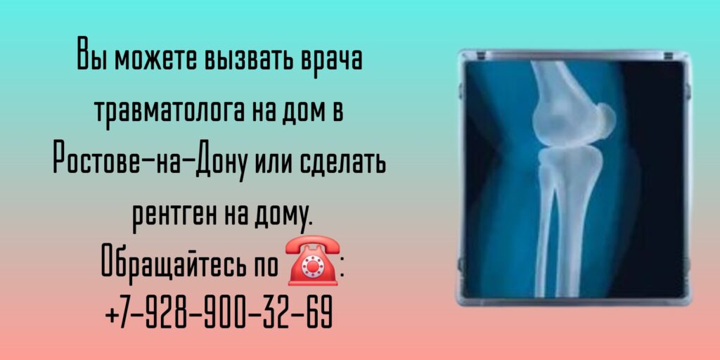 Проведение рентгена на дому в Ростове-на-Дону