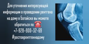 Рентген костей и суставов на дому - в Батайске 