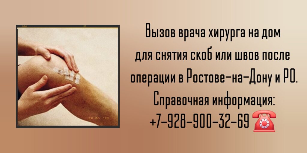 Снять скобы или швы на дому после операции - Ростов-на-Дону 