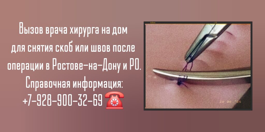 Снять скобы или швы на дому после операции - Ростов-на-Дону 