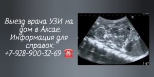 УЗИ брюшной полости на дому Аксай