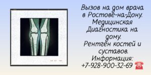 Вызов врача на дом в Ростове-на-Дону- Рентген на дому 