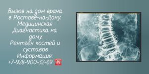 Вызов врача на дом в Ростове-на-Дону- Рентген на дому 