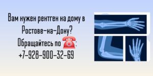 Ростов-на-Дону Рентген тазобедренного сустава на дому 