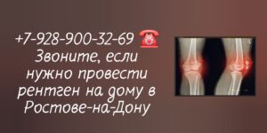 Рентгенография суставов - вызов на дом в Ростове-на-Дону 
