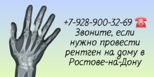 Рентгенография суставов - вызов на дом в Ростове-на-Дону 