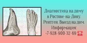 Рентген исследование на дому в Ростове-на-Дону