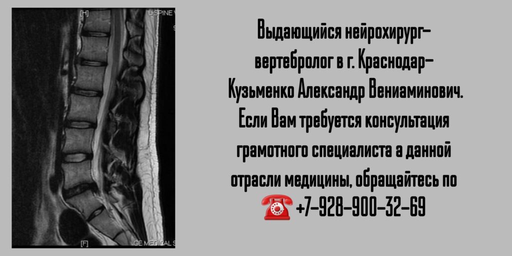 Кузьменко Александр Вениаминович - ведущий нейрохирург- вертебролог в Краснодаре 