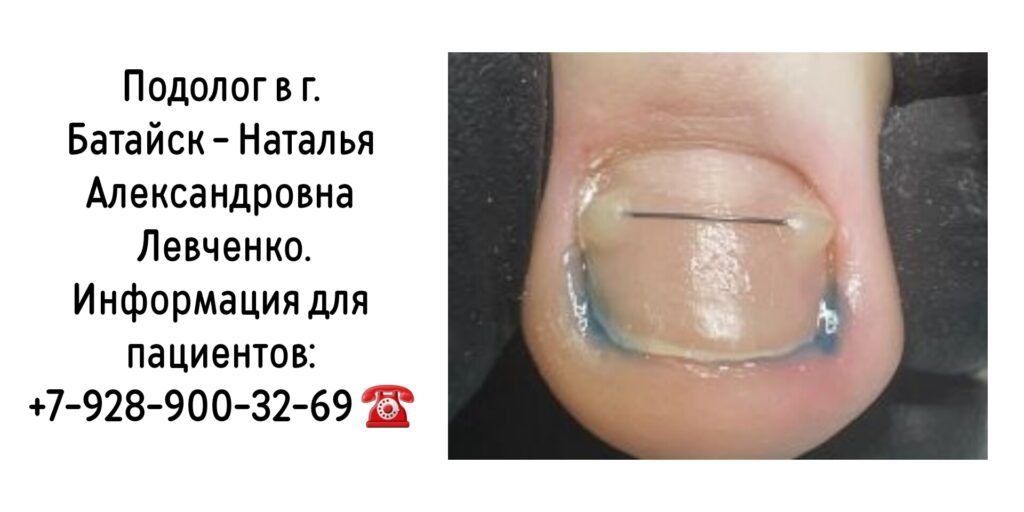 Левченко Наталья Александровна- подолог Батайск