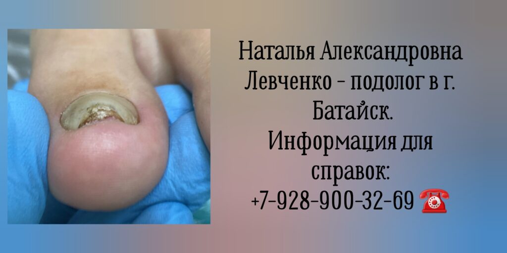 Левченко Наталья Александровна- подолог Батайск