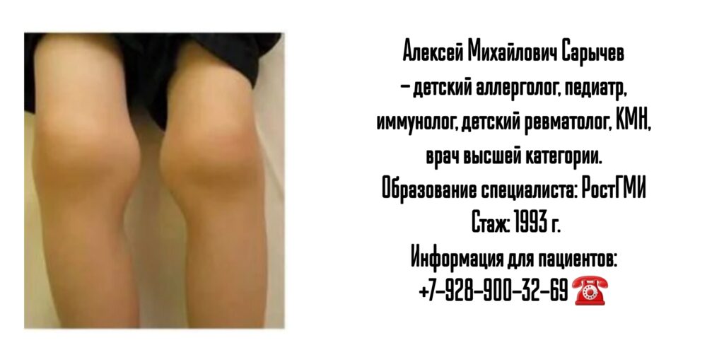 Сарычев Алексей Михайлович - детский ревматолог в Ростове-на-Дону