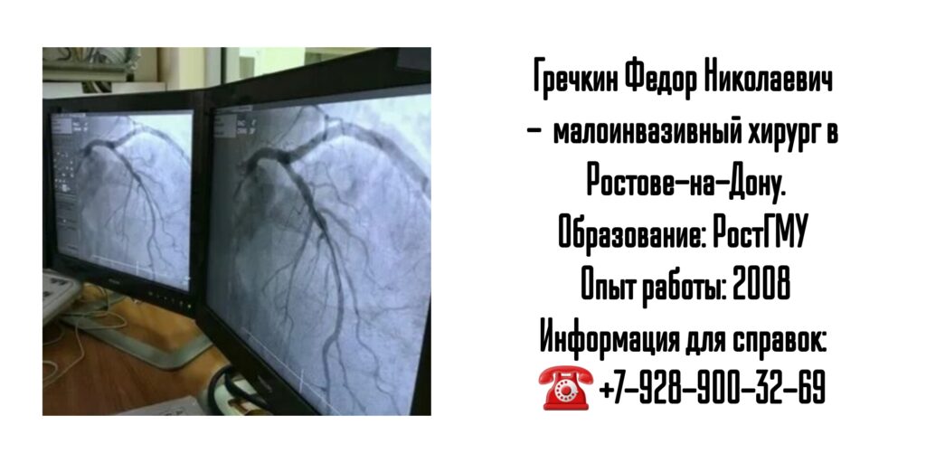 Гречкин Фёдор Николаевич - врач хирург в Ростове-на-Дону- Рентгенэндоваскулярные операции