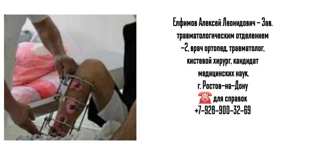 Елфимов Алексей Леонидович- травматолог Ростов
