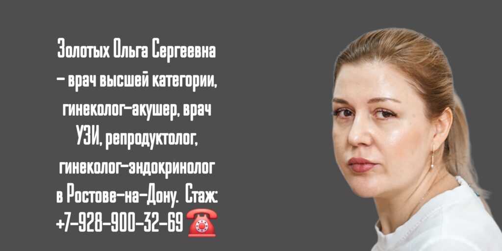 Золотых Ольга Сергеевна- гинеколог Ростов-на-Дону