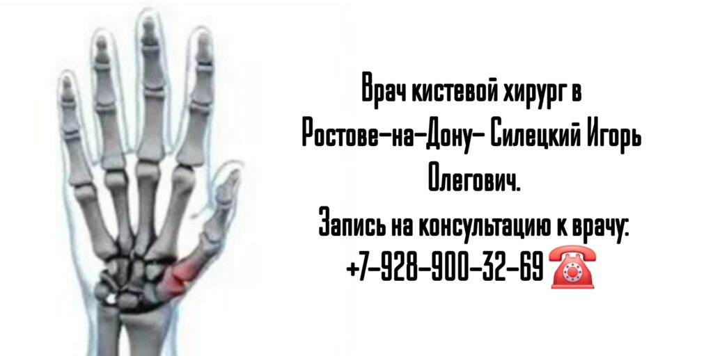 Силецкий Игорь Олегович- хирург кистевой Ростов 