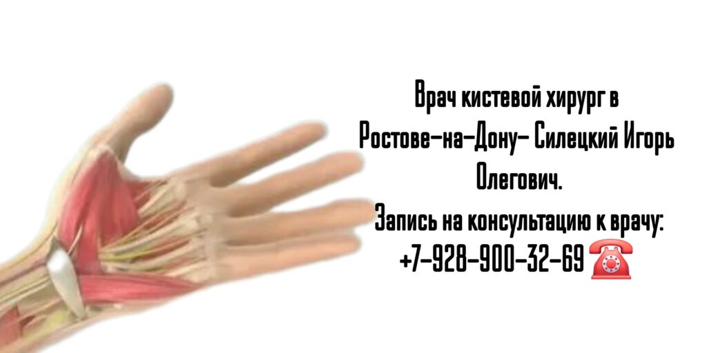 Силецкий Игорь Олегович- хирург кистевой Ростов 