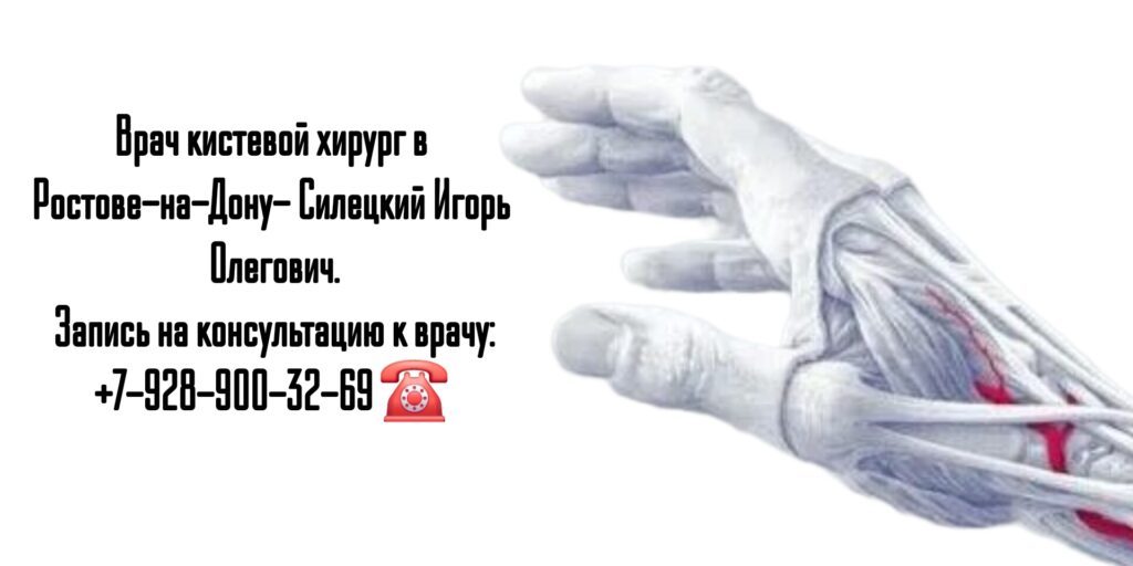 Силецкий Игорь Олегович- хирург кистевой Ростов 